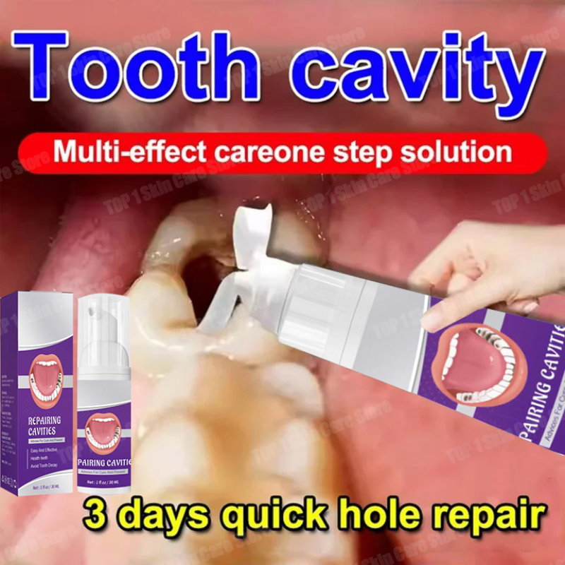 Teeth Whitening That Works - Hot sales Best-selling, Scientific Repairs Cavities,