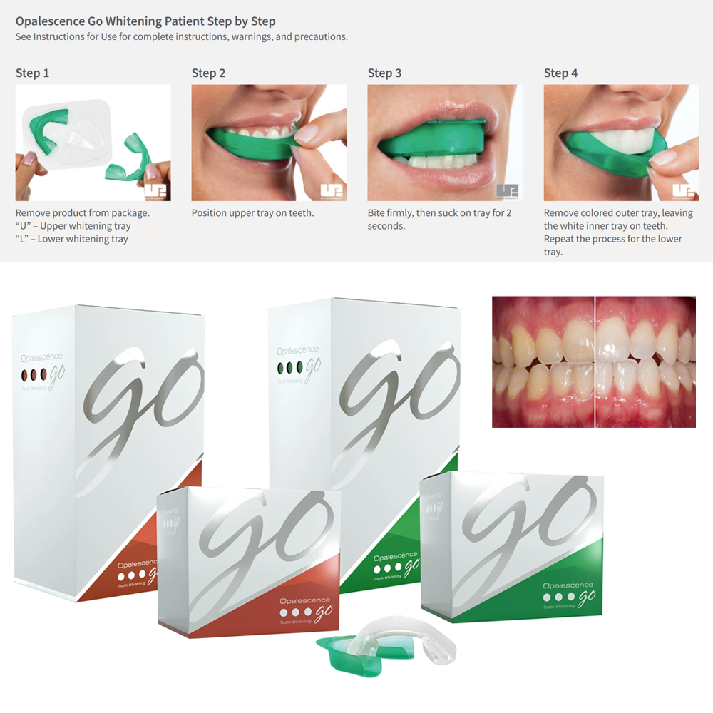 Teeth Whitening At Home Kit - Opalescence Go Teeth Whitening Trays Prefilled