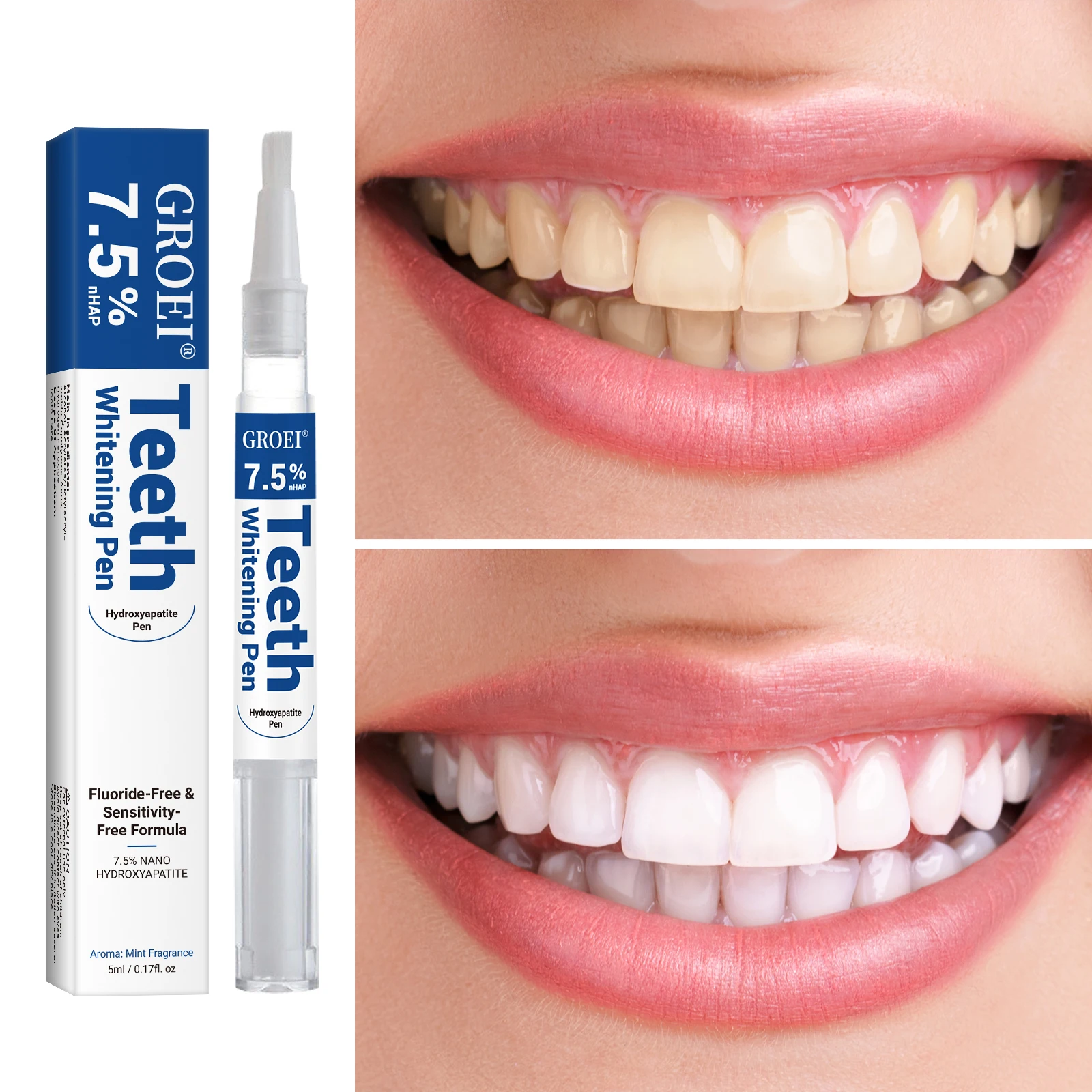 Hydroxyapatite Tooth Whitening - Teeth Whitening With Hydrogen Peroxide avaliação e preço