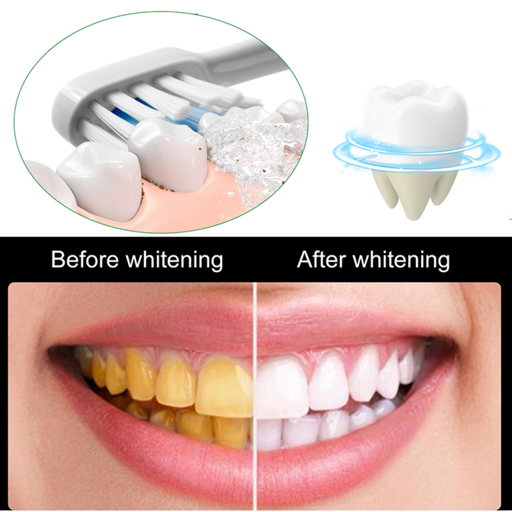 Useful Toothpaste Prevent And  - Whitening Teeth Using Baking Soda avaliação e preço