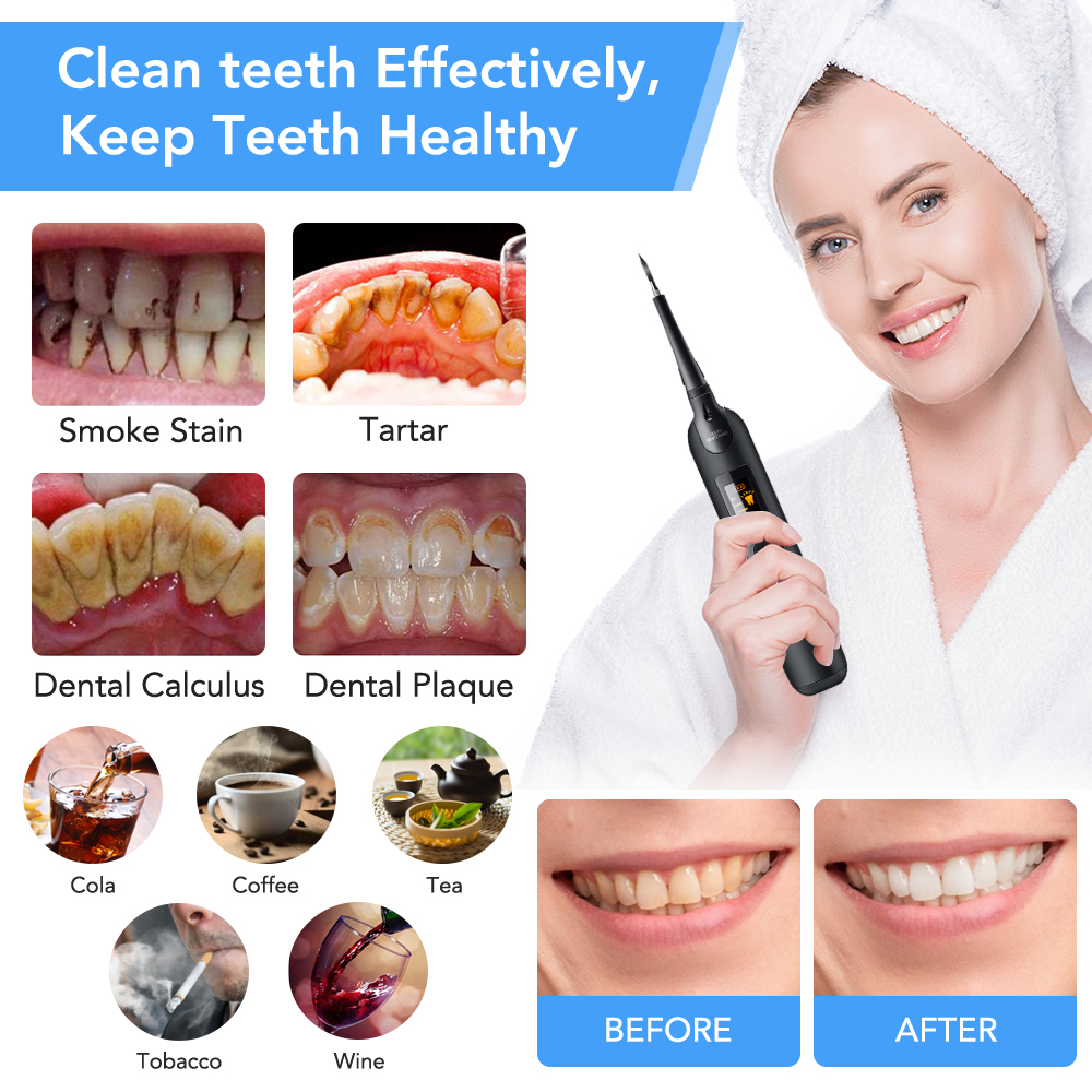 Teeth Tartar Remover Electric  - Teeth Whitening At Home Kit avaliação e preço