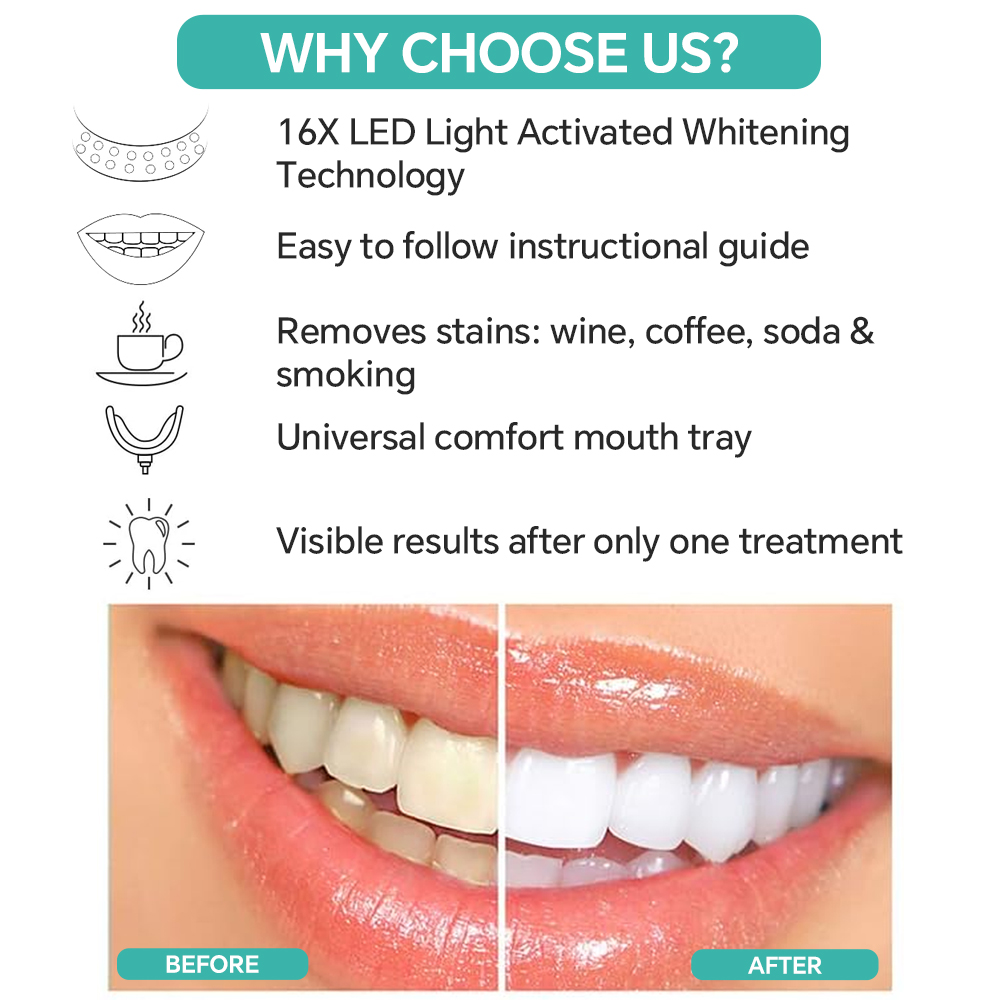 Teeth Whitening Accelerator Li - Teeth Whitening Accelerator avaliação e preço