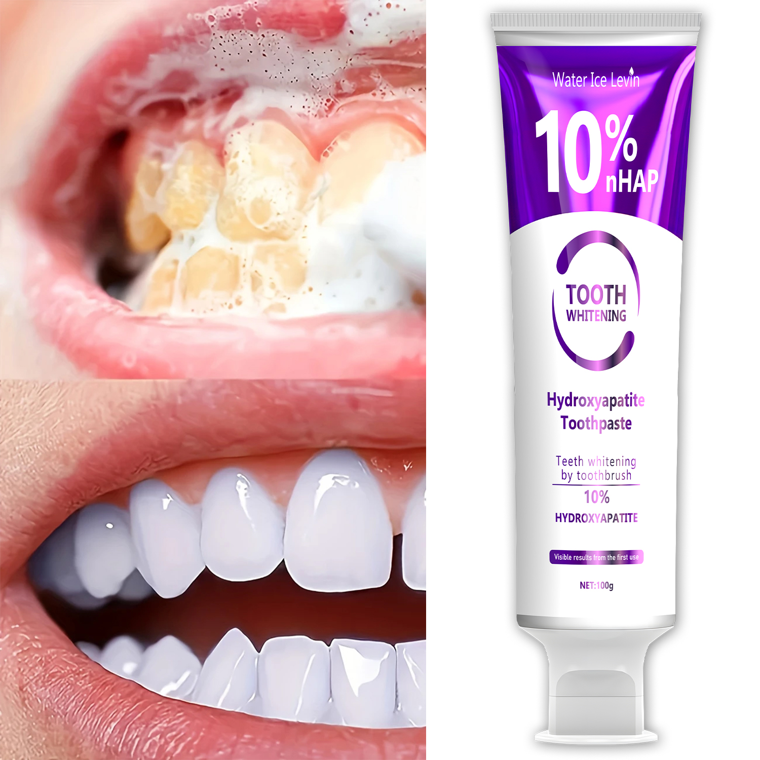 10% Nanoh Hydrogen Oxide Tooth - Teeth Whitening With Hydrogen Peroxide avaliação e preço