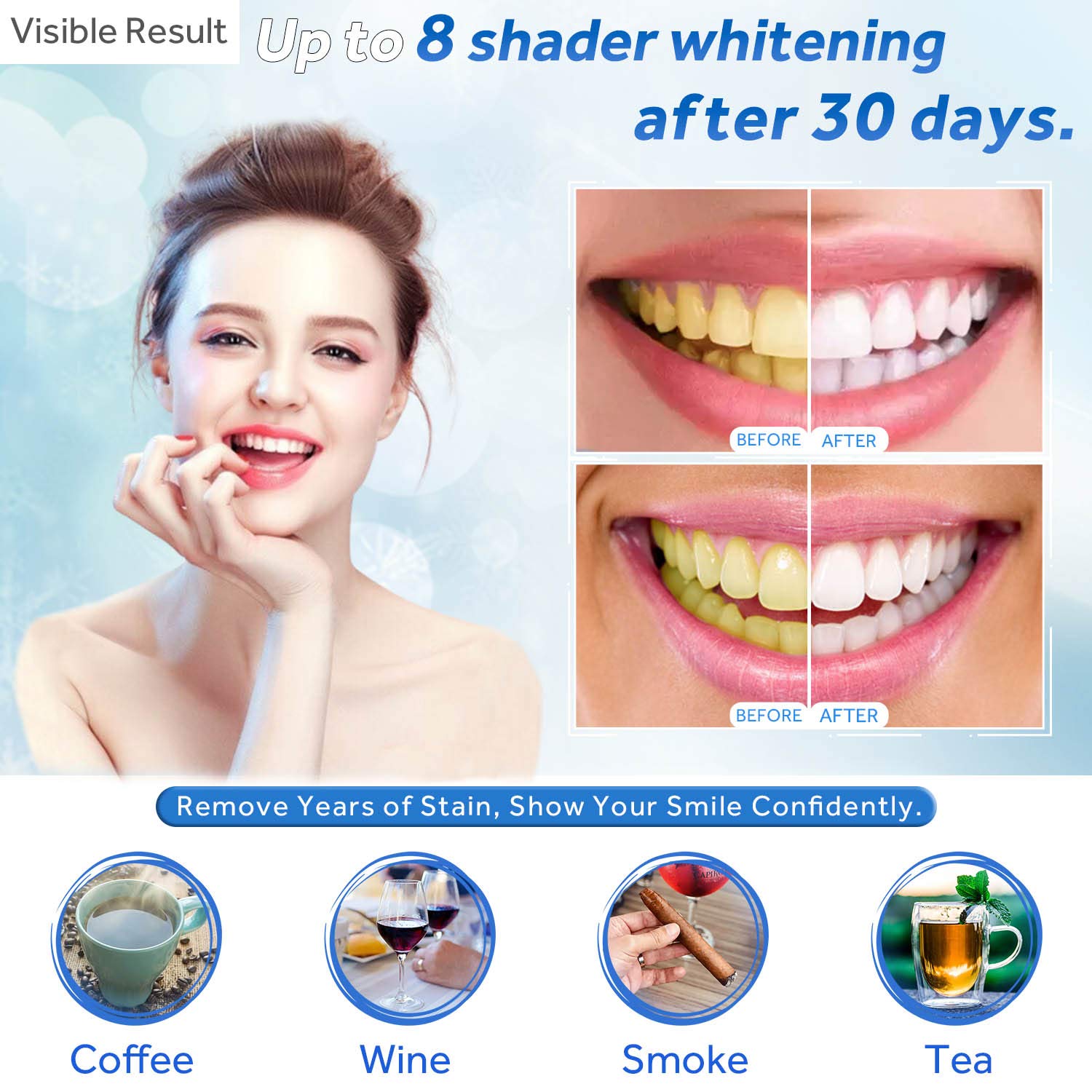 Teeth Whitening Gel Refill Syr - Teeth Whitening With Hydrogen Peroxide avaliação e preço