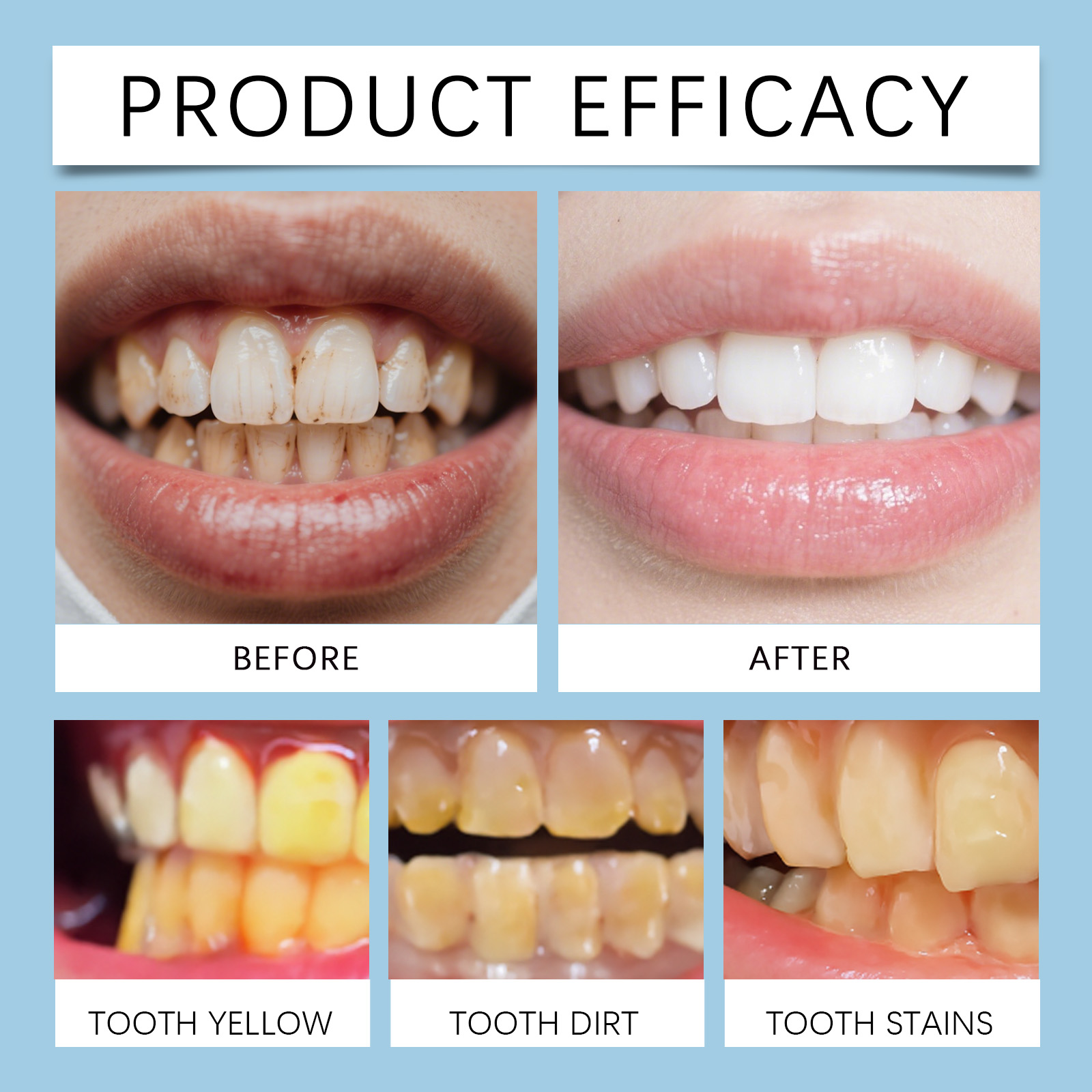 Feimuko 8ml Teeth Gel Pen Gent - Teeth Whitening With Hydrogen Peroxide avaliação e preço