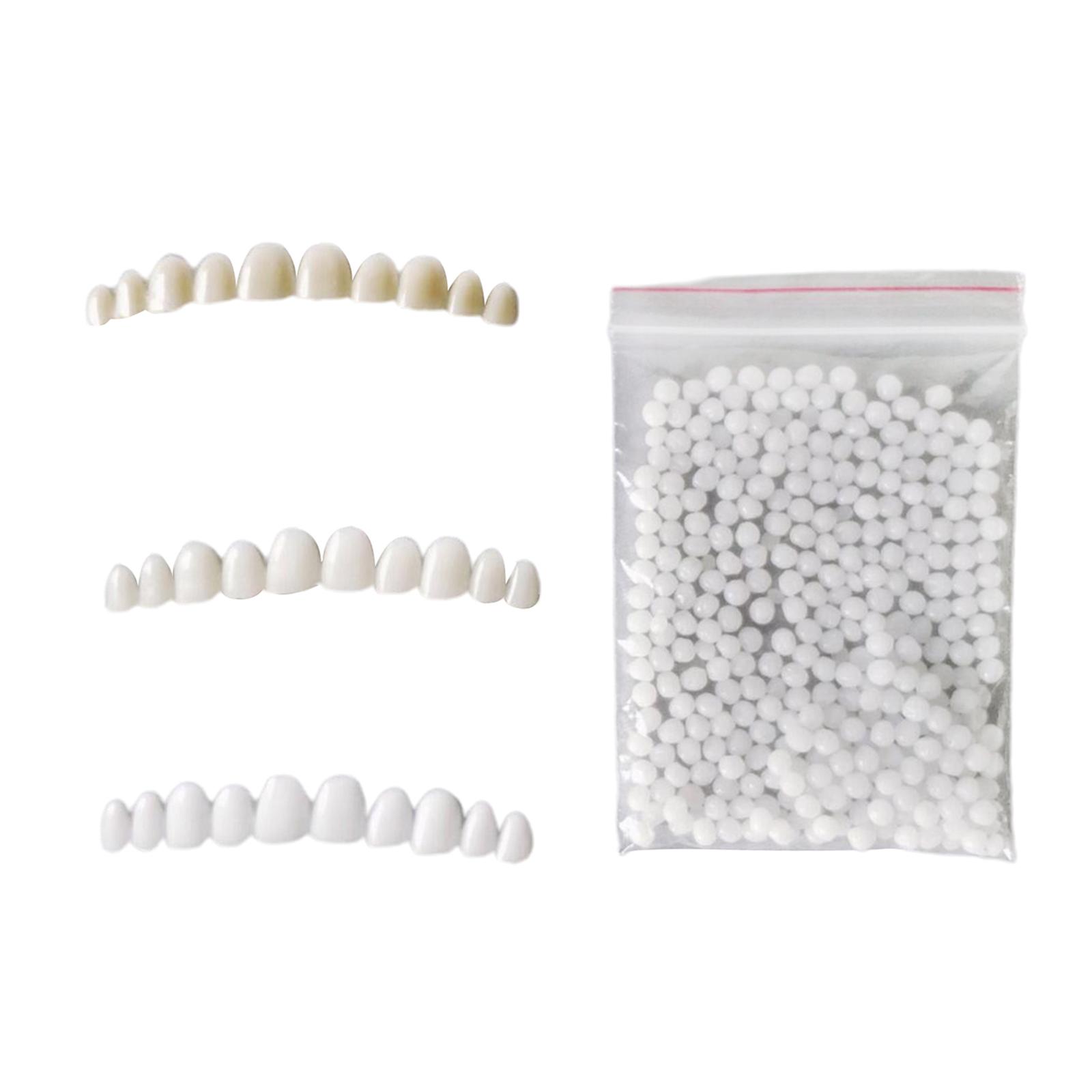 Temporary Teeth Whitening Kit  - Teeth Whitening At Home Kit avaliação e preço