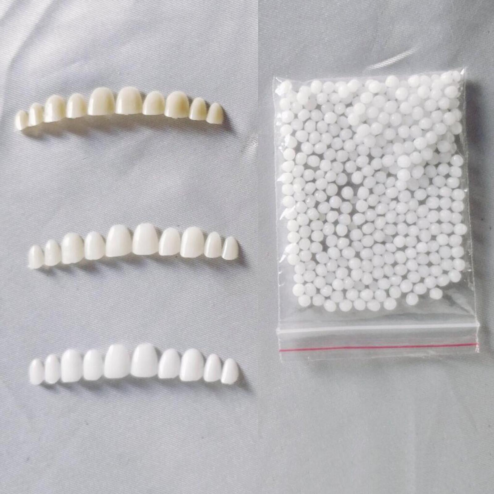Temporary Teeth Whitening Kit  - Teeth Whitening At Home Kit avaliação e preço