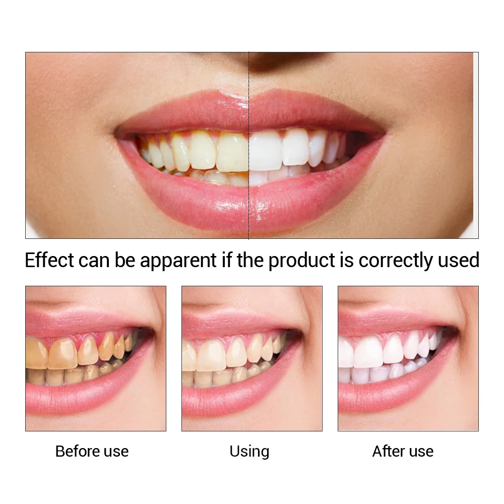 FTEENPLY Teeth Whitening Essen - Teeth Whitening Paste avaliação e preço