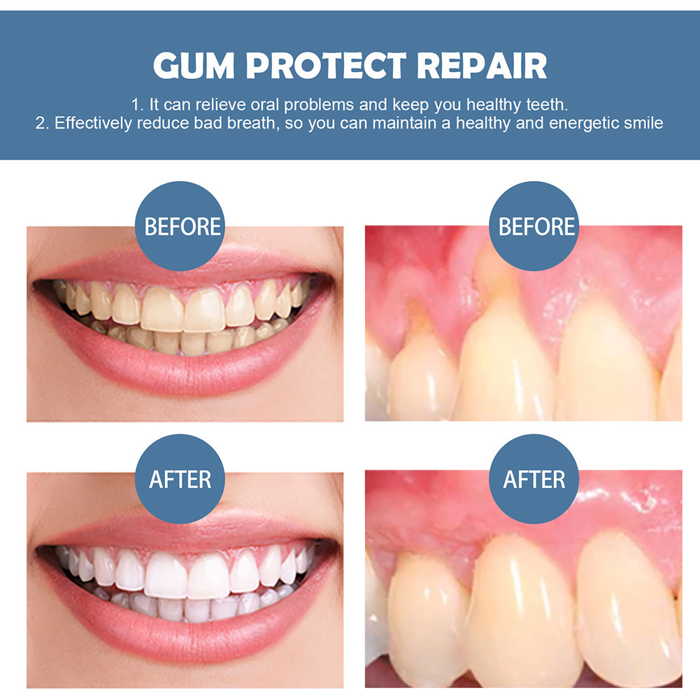 Gum Protection Repair Gel Reli - Teeth Whitening Gel Pen avaliação e preço