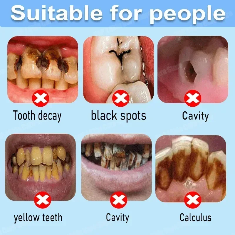 Anti Decay Toothpaste repairs  - Teeth Whitening That Works avaliação e preço