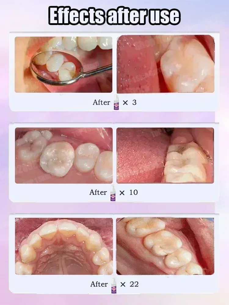 Hot sales Best-selling, Scient - Teeth Whitening That Works avaliação e preço