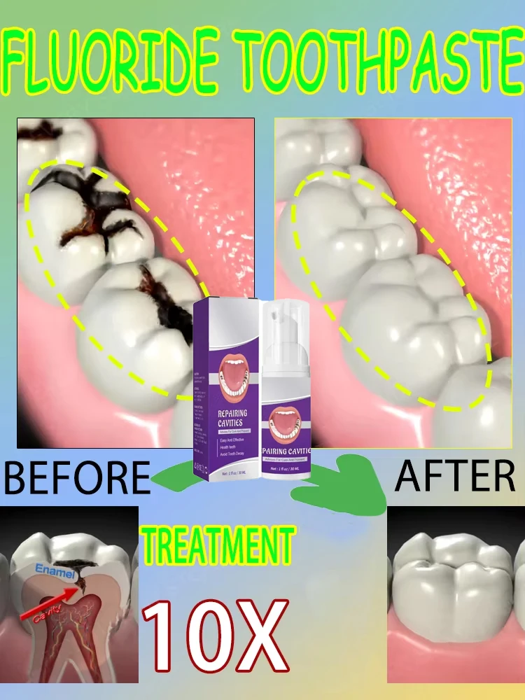 Hot sales Best-selling, Scient - Teeth Whitening That Works avaliação e preço