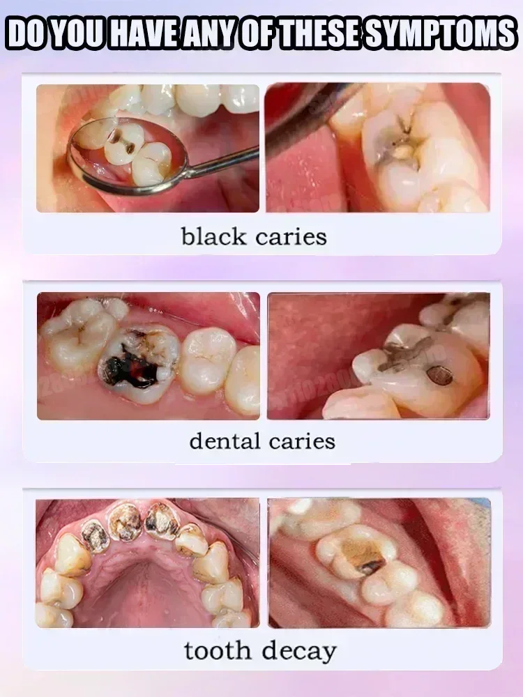 Hot sales Best-selling, Scient - Teeth Whitening That Works avaliação e preço