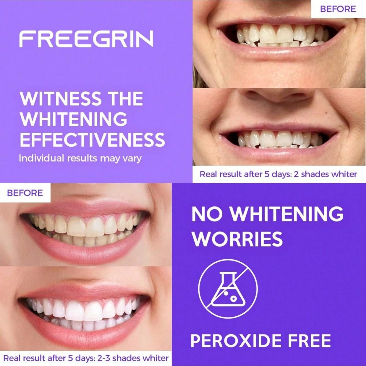 Deluxe Whitening Teeth Sticker - Teeth Whitening With Hydrogen Peroxide avaliação e preço
