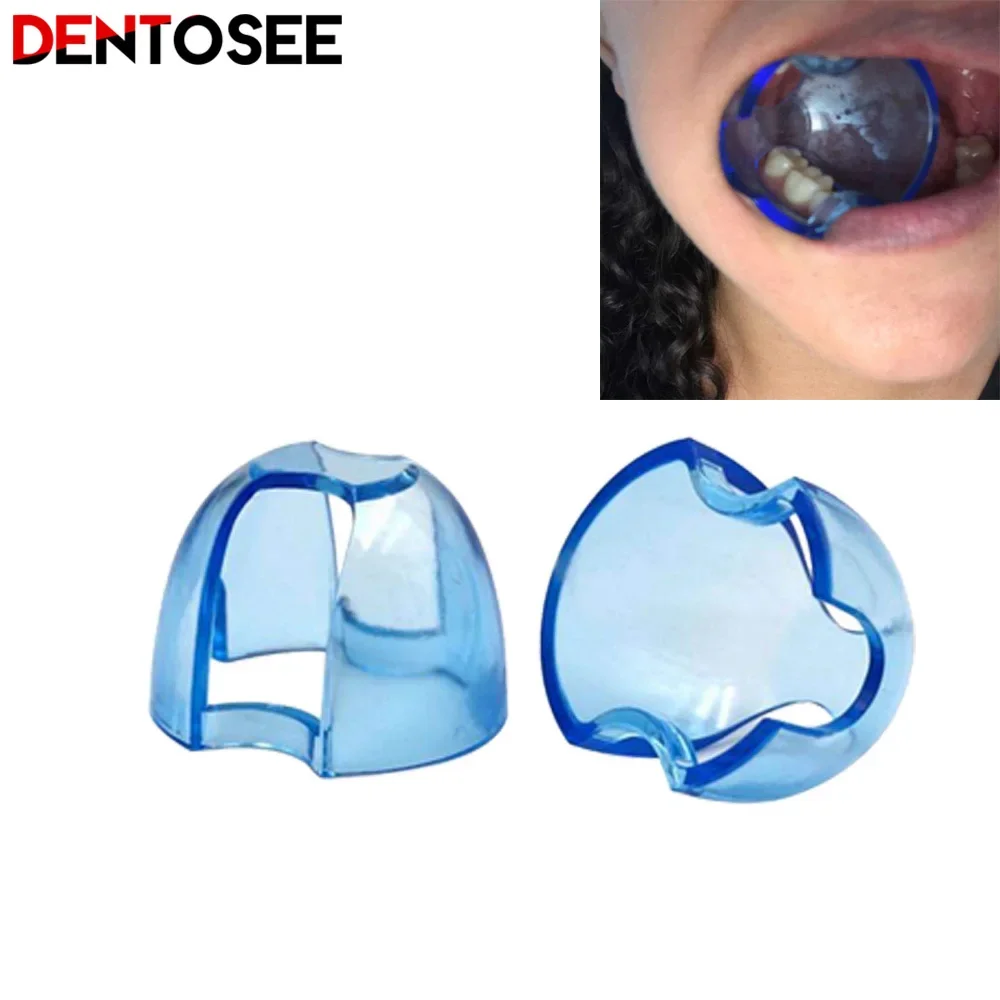Dental Intraoral Cheek Retract - Teeth Whitening Accelerator avaliação e preço