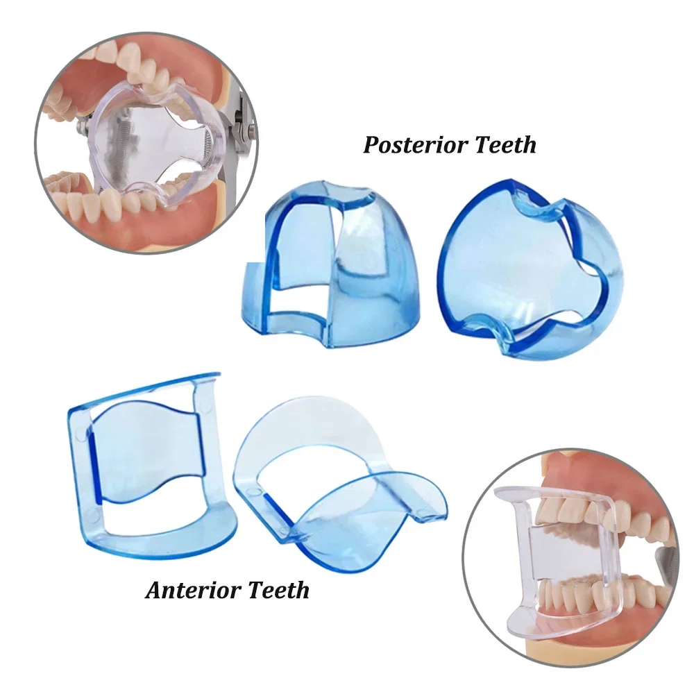 Dental Intraoral Cheek Retract - Teeth Whitening Accelerator avaliação e preço