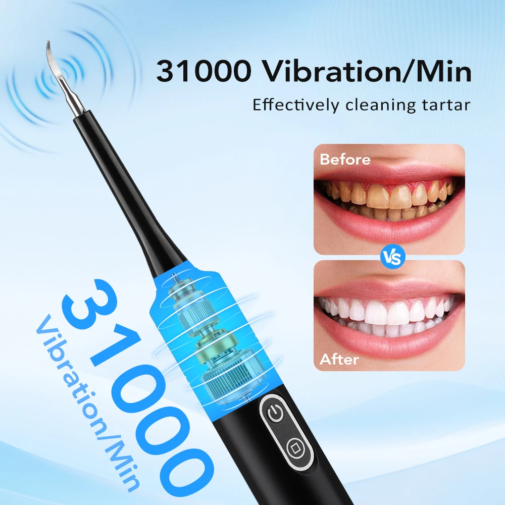 Electric Sonic Vibration Denta - Electric Toothbrush Sonic avaliação e preço