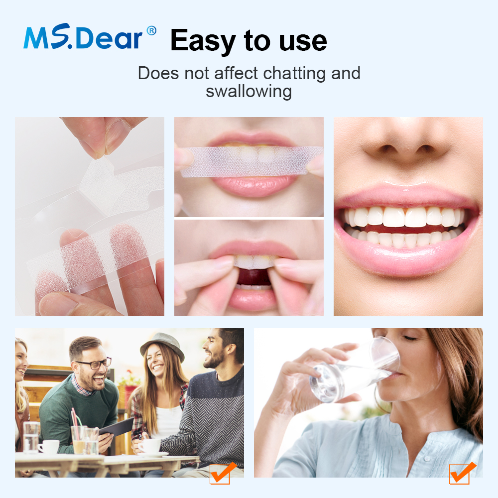 Teeth Whitening Strips Cleansi - Teeth Whitening With Hydrogen Peroxide avaliação e preço